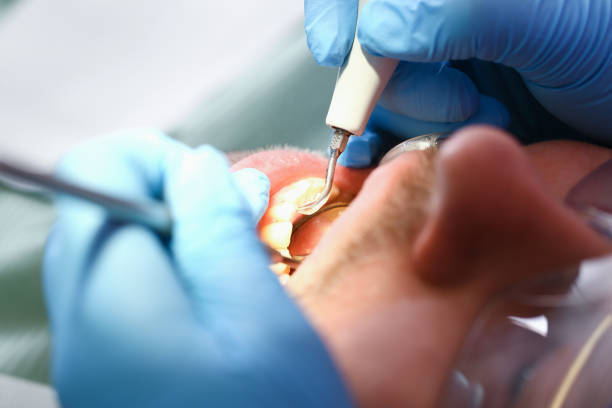 Best Walk-In Emergency Dental Services in Dorr, MI
